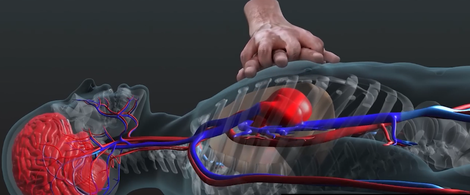 Medical Device Animation